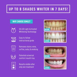iSmile Teeth Whitening Kit – LED Light, 35% Carbamide Peroxide, (3) 3ml Gel Syringes, (1) Remineralization Gel, and Tray.